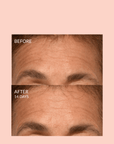 Triple Lift Molecule Mask